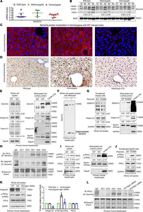 ada nafld,Understanding NAFLD: A Comprehensive Guide